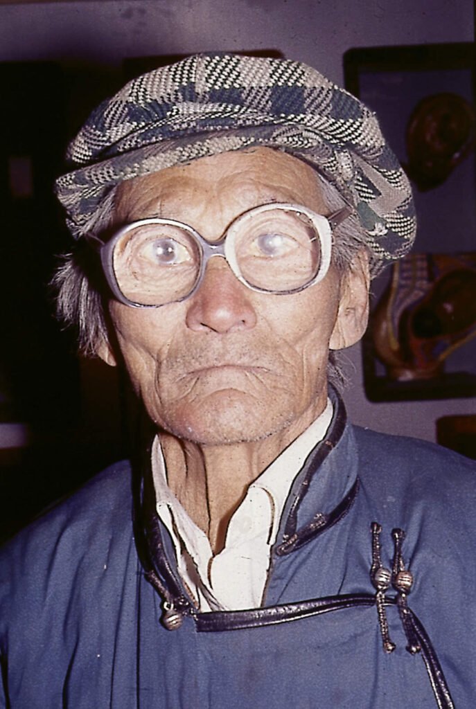Aphakic glasses1