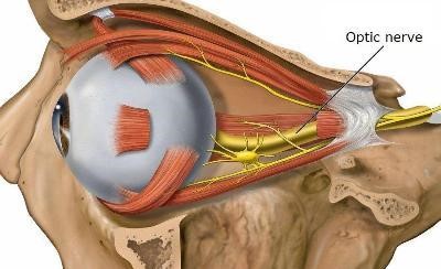 Optic Nerve آپٹک-نرو