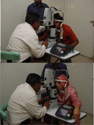 Yag Capsulotomy