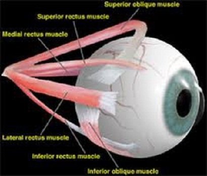 Squint repair