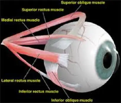 Squint repair
